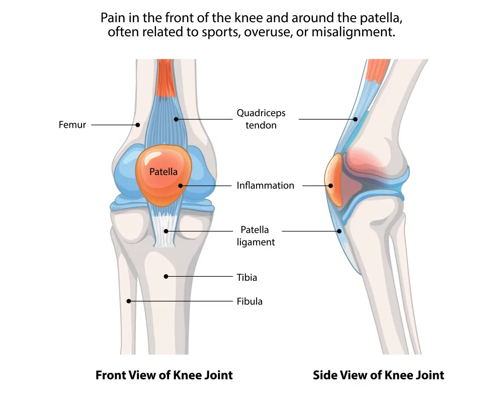 Learn why knee pain often gets worse at night and how knee pain relief patches help. Discover circulation based, drug free solutions for overnight comfort.
