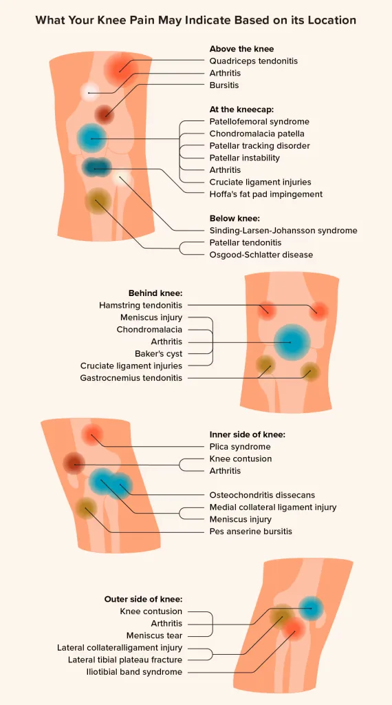 Can you sleep with a knee pain relief patch on? Learn about safety, comfort, and how overnight knee patches help reduce pain and morning stiffness.