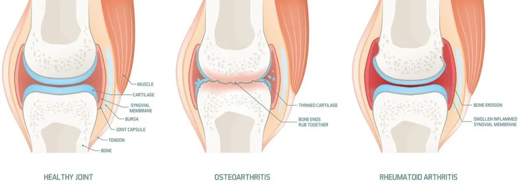 Learn how long knee pain relief patches take to work, what to expect in the first 24–72 hours, and how to get better results with consistent use.
