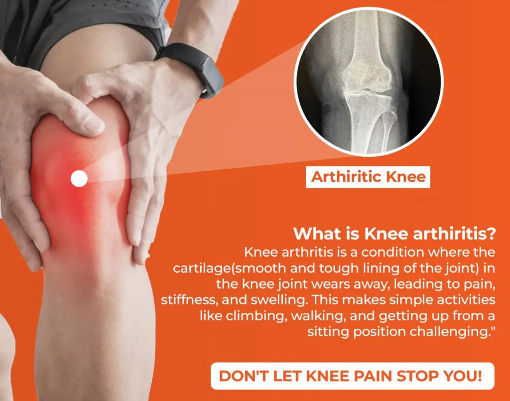 Do knee pain relief patches help arthritis? Learn what magnetic knee patches can and cannot do for arthritis related knee pain and stiffness.